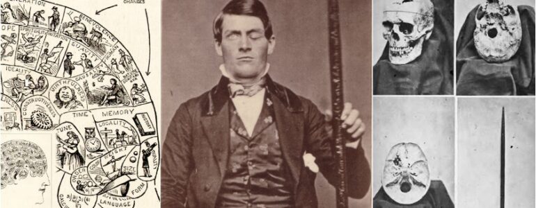 Phineas Gage