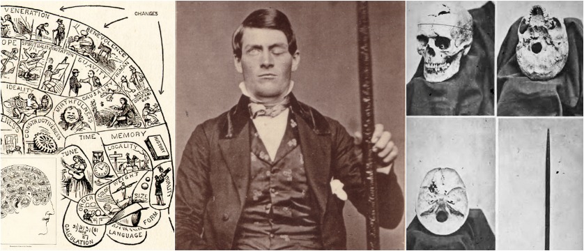 The Gruesome Story Of Phineas Gage How A Severe Work Place Accident 